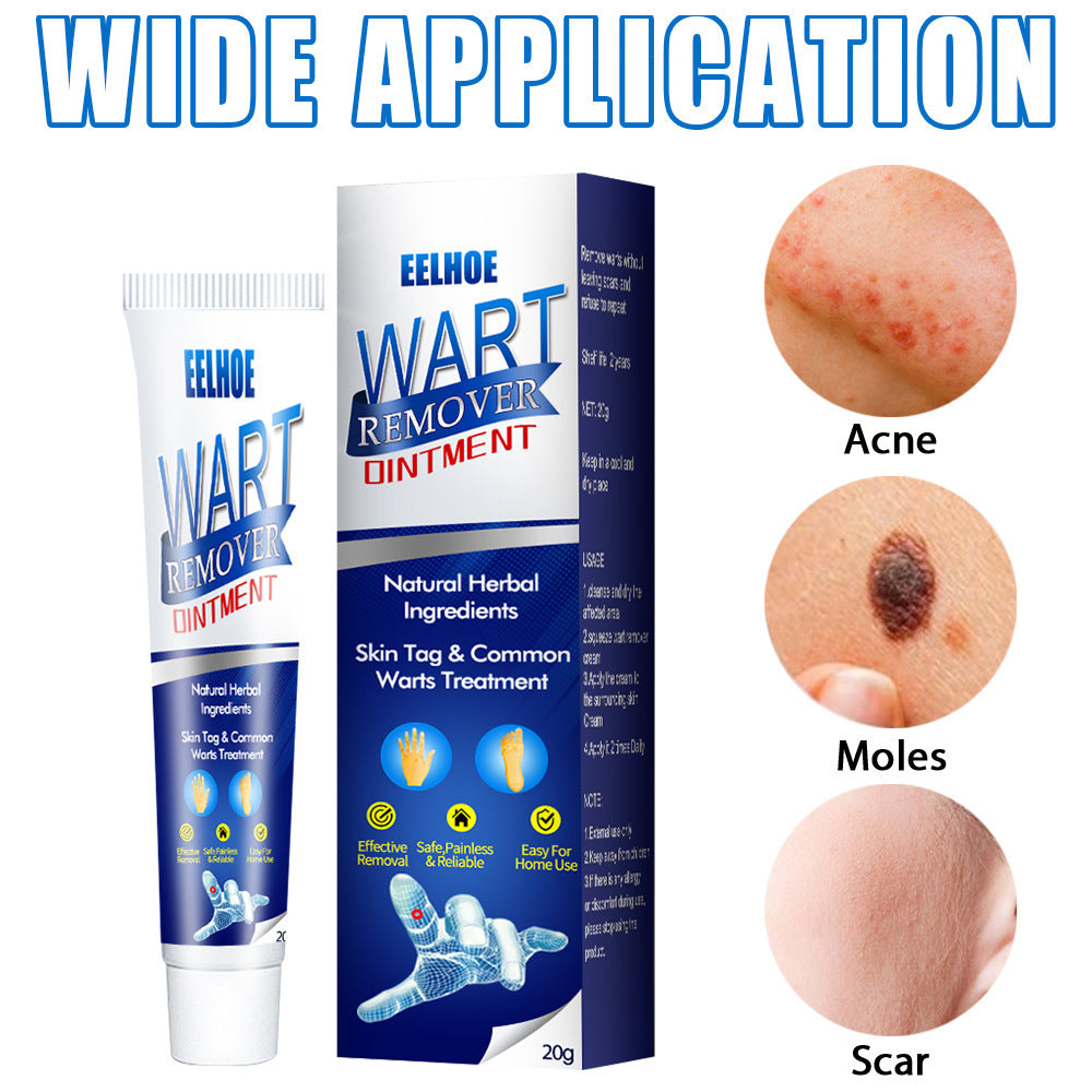 Zhongcao Keyou Liquid Skin Warts Ordinary Yukeyou Skin care lotion Wart Removing Cream